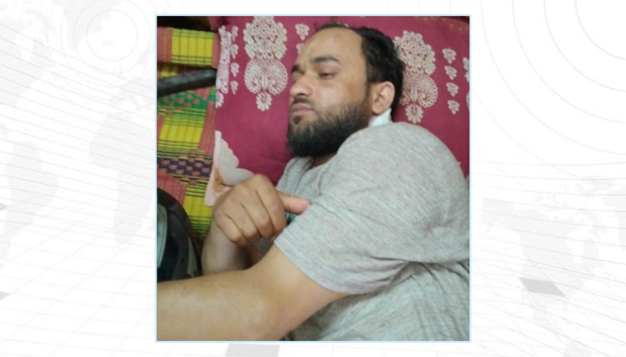 ভোররাতে জানালার গ্রিল ভেঙে হামলা: যশোরে ওষুধ কোম্পানির প্রতিনিধিকে কুপিয়ে জখম