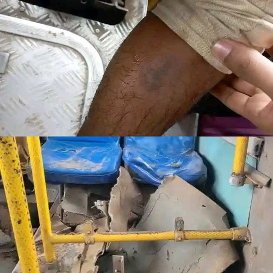 পদুয়ার বাজারে কুবির বিআরটিসি বাসের চাকা বিস্ফোরণ, আহত দুই শিক্ষার্থী